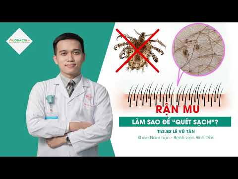 Video: Tại sao rệp lại nguy hiểm cho một người trong căn hộ và chúng mang những bệnh gì?