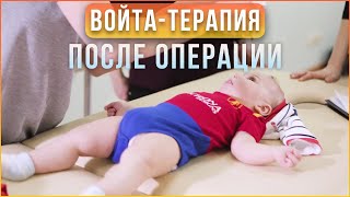 Войта-терапию после операции - Можно ли применять детям и взрослым