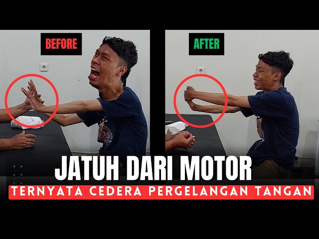 JATUH DARI MOTOR TERNYATA CEDERA PERGELANGAN TANGAN class=