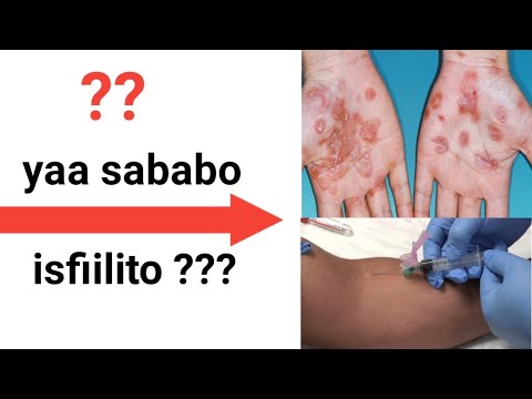 Onlayn gig porno va birodarlar