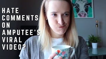 3 MONTHS AFTER AMPUTATION - Plus Responding to Angry & Hate Comments