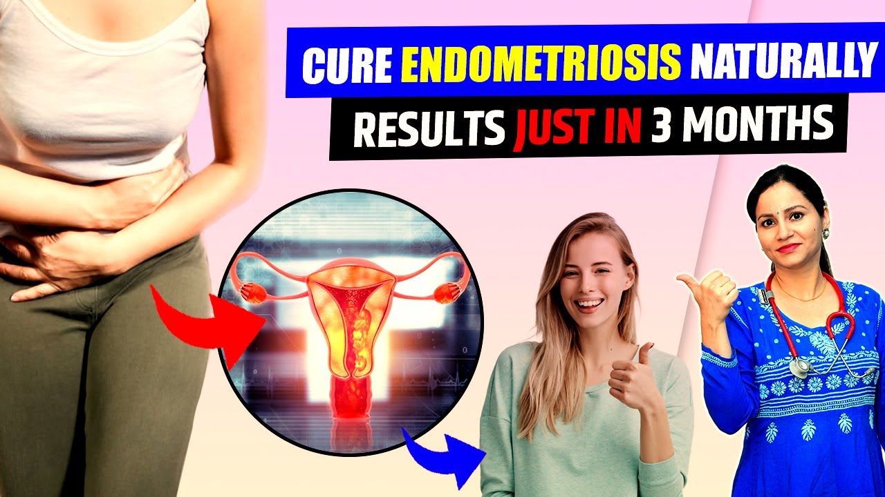 Natural Ayurvedic Home Remedies for Endometriosis Ayurvedic Treatment