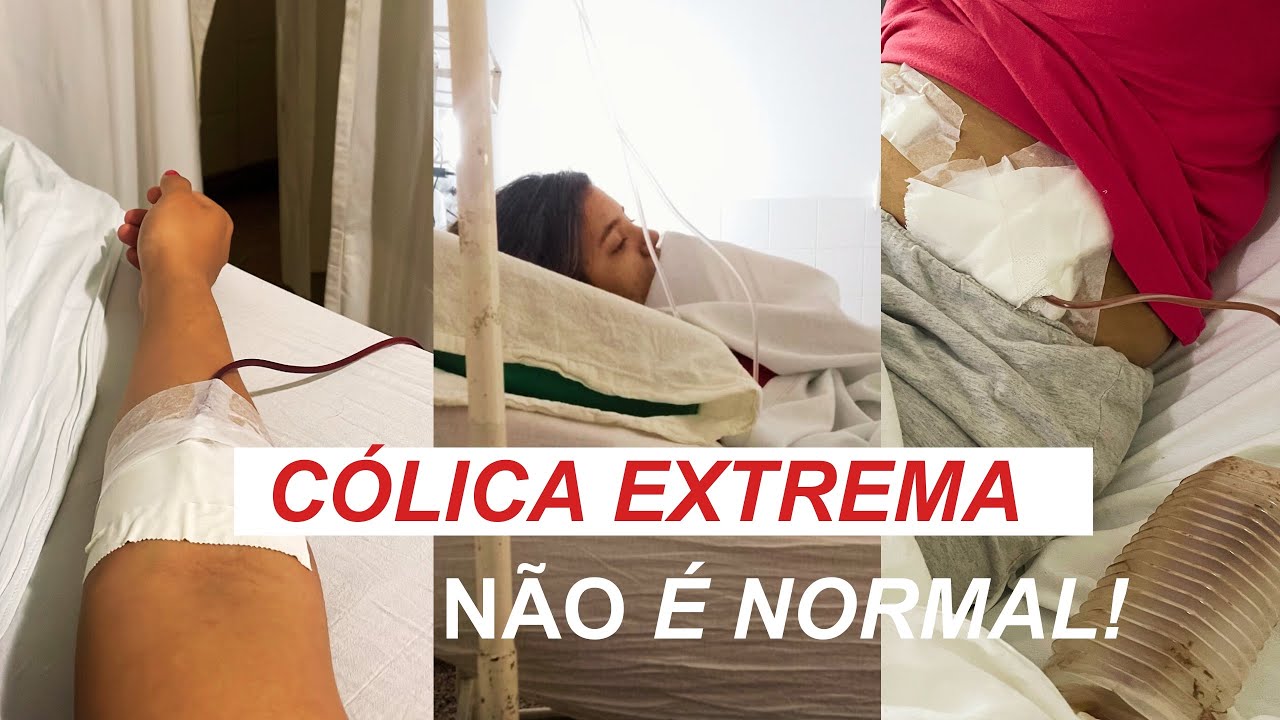 🚨🚨Fui diagnosticada com endometriose + relato da minha cirurgia de cisto ovariano hemorrágico 