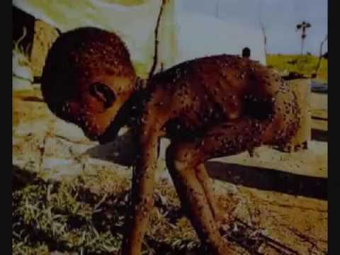 Video: Hladomor V Somálsku. Stále Sa To Deje. - Sieť Matador