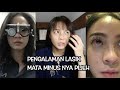 YANG MAU LASIK MATA MINUS NONTON INI DULU!