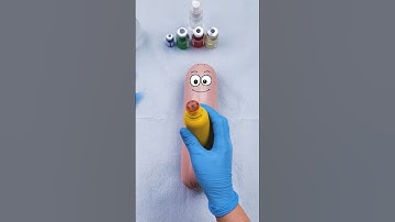 Emergency C section, sausage gives birth to a nugget! 💉😯