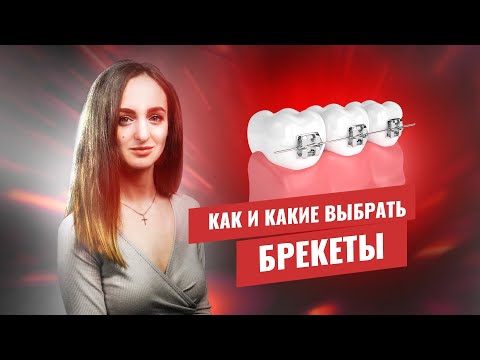 🇺🇦 Какие брекеты выбрать