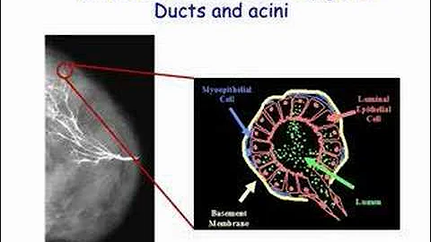 Genes and the Microenvironment: Two Faces of Breast Cancer