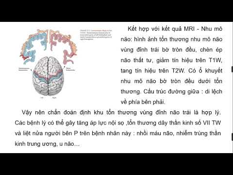 GB bệnh án u não Y4 09/09/2021