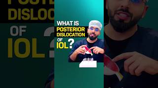 What is Posterior Dislocation of IOL?