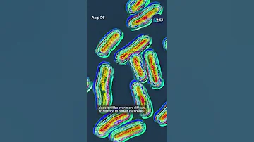 CDC Stops Tracking Key Food Borne Illnesses Newsupdate Uspolitics 