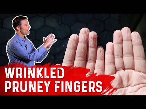 Video: Pruney Fingers: Penyebab, Kekhawatiran, Pengobatan, Dan Banyak Lagi