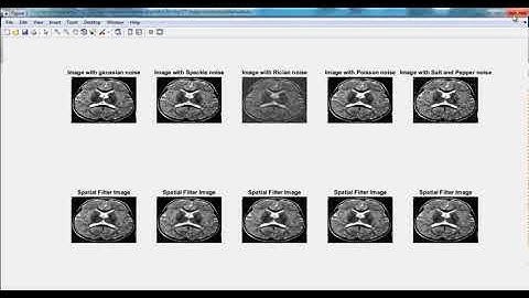 Major Projects for Ece in Digital Image Processing