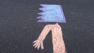 "Neurology", Unilateral Neglect