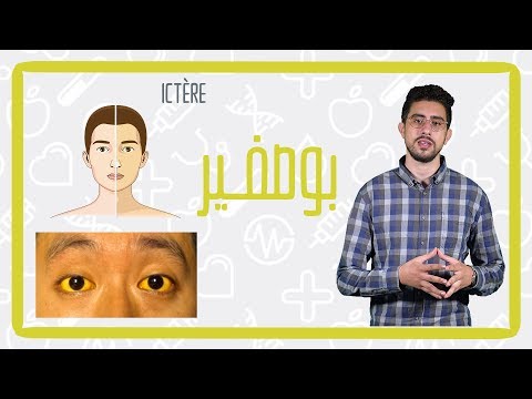 اسباب واعراض بوصفير