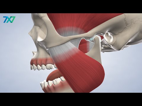 TMJ Treatment in San Francisco, CA | 7x7 Dental Implant & Oral Surgery Specialists