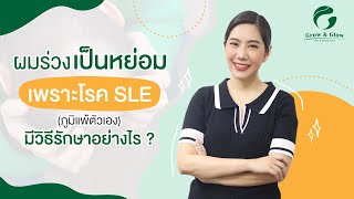 ผมร่วงเป็นหย่อม เพราะโรค SLE (ภูมิแพ้ตัวเอง) มีวิธีรักษาอย่างไร ?