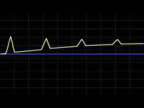 Mannequins Mangrove with Batumi Random waveforms