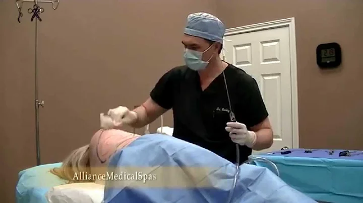 Laser Lipo at Alliance Medical Spa