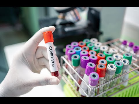 კორონავირუსის ინფიცირების 5 ახალი შემთხვევა და 14 გამოჯანმრთელებული