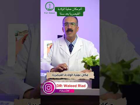 ألم مكان جرح الولادة القيصرية بعد سنة ايه الاسباب والحلول