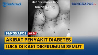 Video Penampakan Luka di Kaki Dikerumuni Semut akibat Penyakit Diabetes