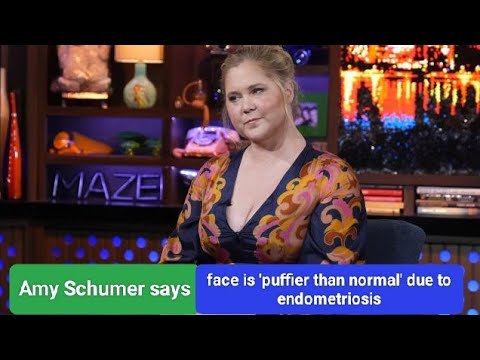 What is Cushing syndrome and how does it affect Amy Schumer ...