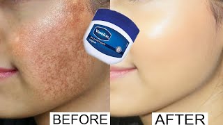 Vaseline for face pigmentation overnight | Vaseline on face at night benefits | Vaseline on face