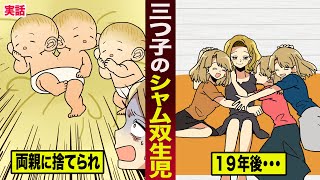 【感動】両親に捨てられた...三つ子のシャム双生児。19年後の姿が泣ける。