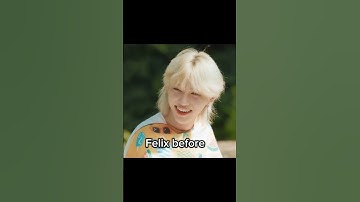 K-pop idols who got unnecessary plastic surgery#felix