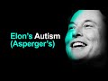 Why Elon Musk's Autism (Asperger's) Makes Him A GREAT Leader