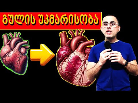 გულის უკმარისობის ტოპ 5 ნიშანი  -  როგორ გავიგოთ რომ გულს უჭირს?