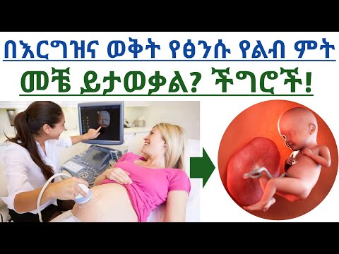 ቪዲዮ: በእርግዝና ወቅት የልብ ምት ይመታል?