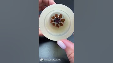 PACKING Emax press #dentalart #dentallab #emax #teeth #veneers #зубнойтехник #зубнойтехникмосква