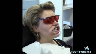 Tooth Fairy Tooth Whitening Method 2