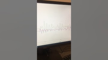 Accelerometer MPU6050