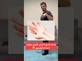 علاج تنميل اليد والأصابع بهذي الطريقه السهله 🤩. #علاج_طبيعي #pov
