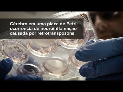 Vídeo: Os Cientistas Desenvolveram Um Mini-cérebro Em Uma Placa De Petri - Visão Alternativa