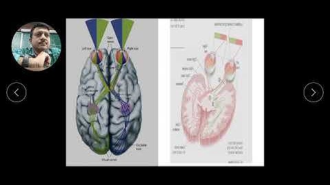 PERIMETRY, PERIPHERAL VISUAL FIELD EXAMINATION