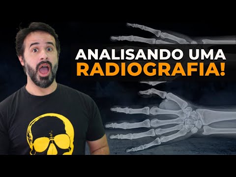 Vídeo: Què es deixa entrar en radiografia?
