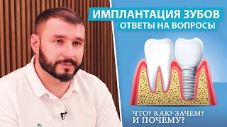 Имплантация зубов - ответы на самые популярные вопросы