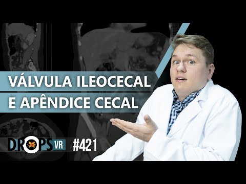 Vídeo: O que é a junção ileocecal?