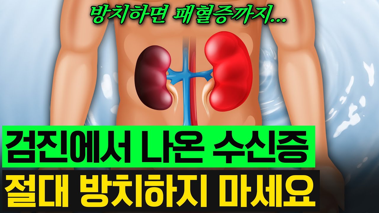 건강검진·초음파에서 ‘수신증’ 나왔다면 꼭 확인해야 할 3가지