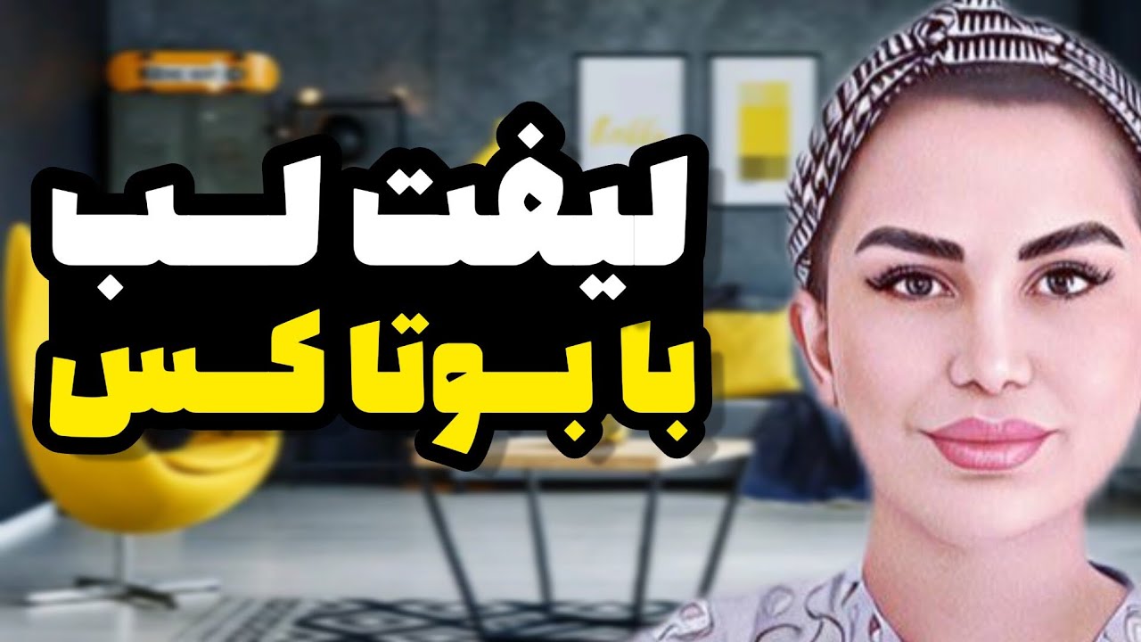 آموزش لیفت لب با بوتاکس