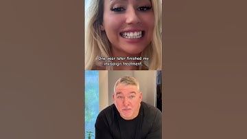 You all deserved a glow-up up this nice #retainer #aligner #invisalignjourney