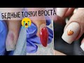 Точки вроста ПОСТРАДАЛИ от переношенных ногтей 😭 СЕРДЕЧКИ на ногтях ❤️ Маникюр на 14 февраля.