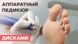 Аппаратный педикюр дисками за 20 минут! Реально?