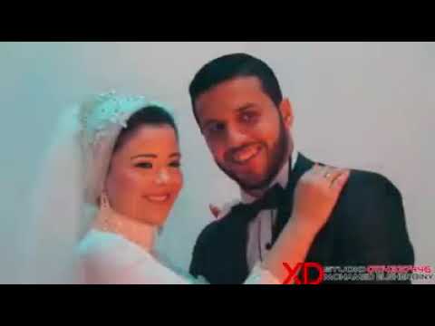 انتى اللى زايك عمله نادره