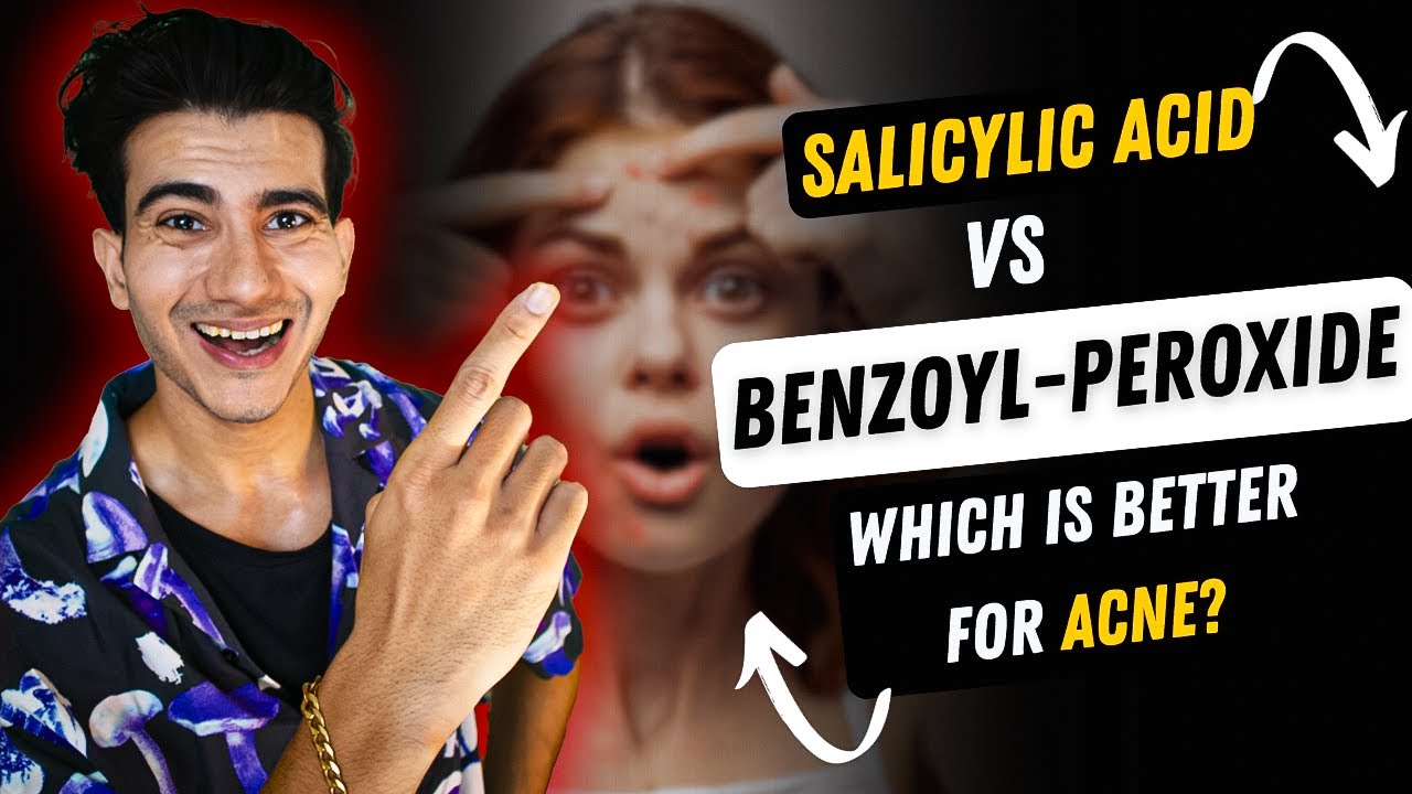 SALICYLIC ACID VS BENZOL PEROXIDEWHO WINS? salicylic acid benzoyl