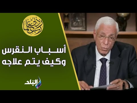 مرض علاجه سهل الدكتور حسام موافي يكشف أسباب النقرس وكيف يتم علاجه